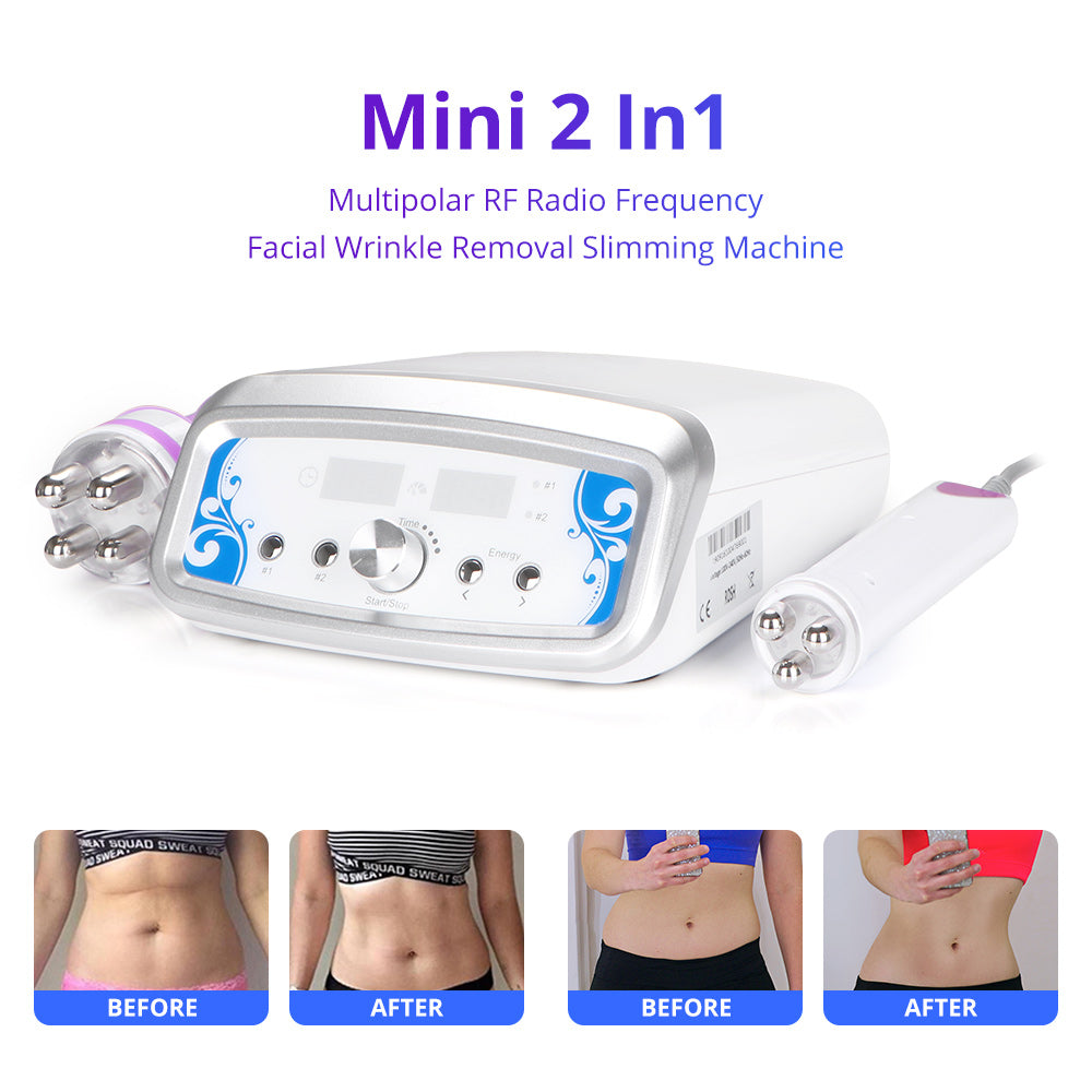 Mini 2 In1 Multipolar RF Radio Frequency Facial Wrinkle Removal Body Contouring Machine