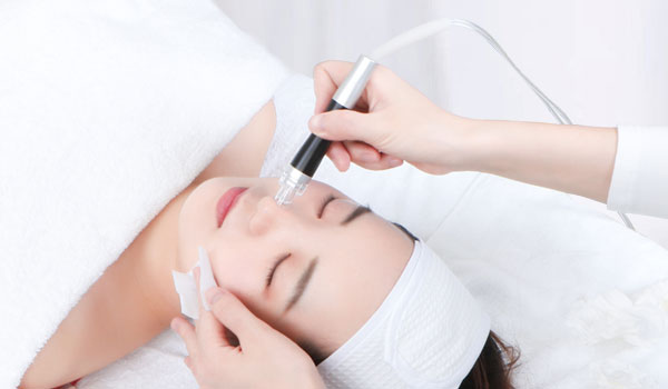 FAQs About Microdermabrasion